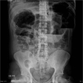 CAMPANHA DE RECICLAGEM DE RADIOGRAFIAS DA AMI